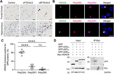 HDAC6 Interacts With Poly (GA) and Modulates its Accumulation in c9FTD/ALS